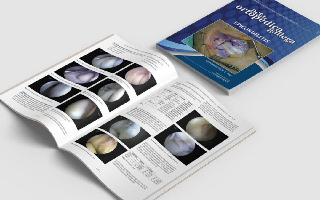Diseño y maquetación editorial para revista médica SOGACOT en su monográfico especializado